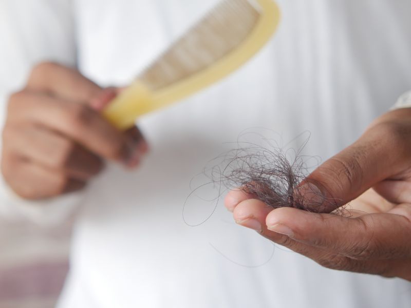 perte de cheveux diffuse effluvium télogène chute cheveux brosse main