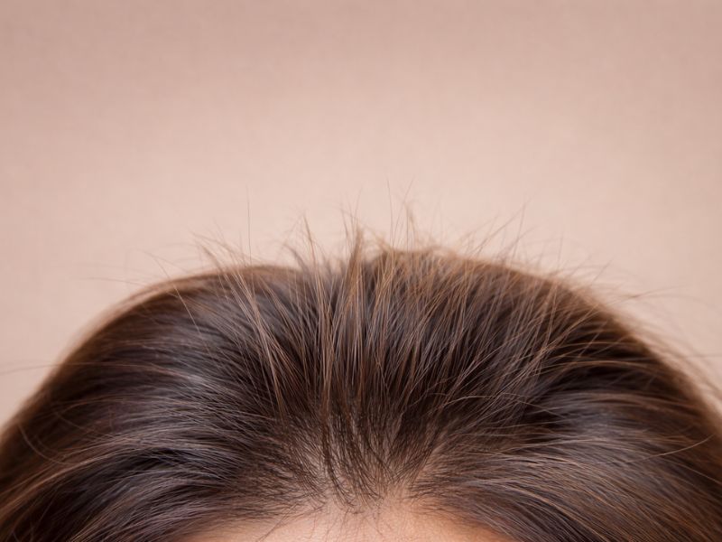 repousse cheveux après effluvium télogène nouveaux cheveux racines début repousse capillaire