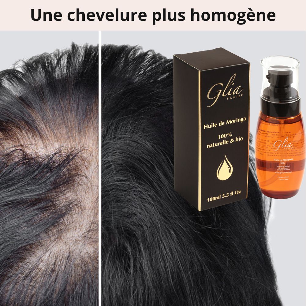 vue sur des cheveux Pack Ultime Repousse 